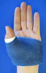 tell if you broke your thumb ligament