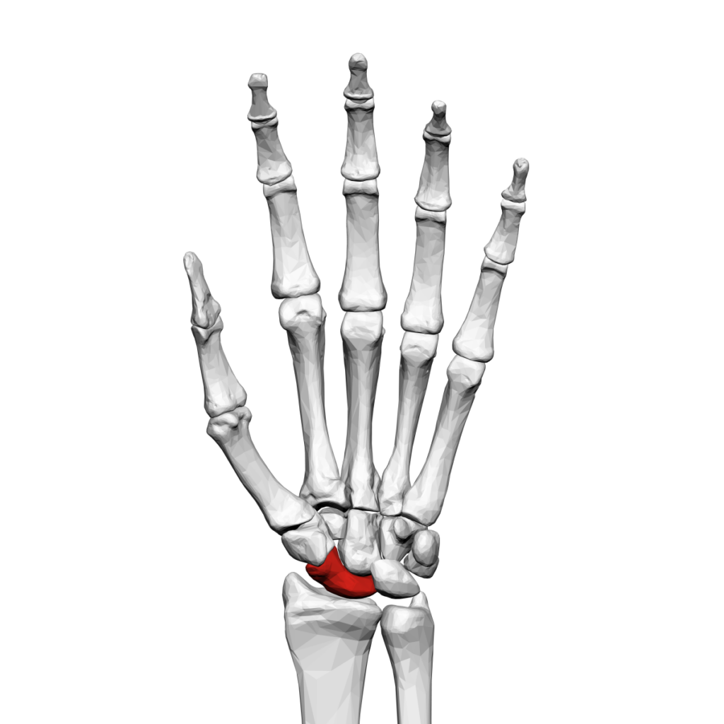 Scaphoid bone that can be affected by a scaphoid bone fracture and require treatment
