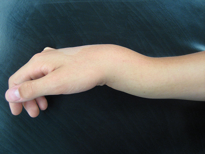 Gym Pain? Protecting the Hands and Wrists Manchester