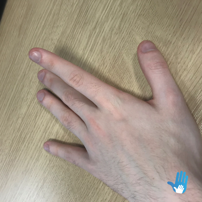 finger lifts exercise for osteoarthritis