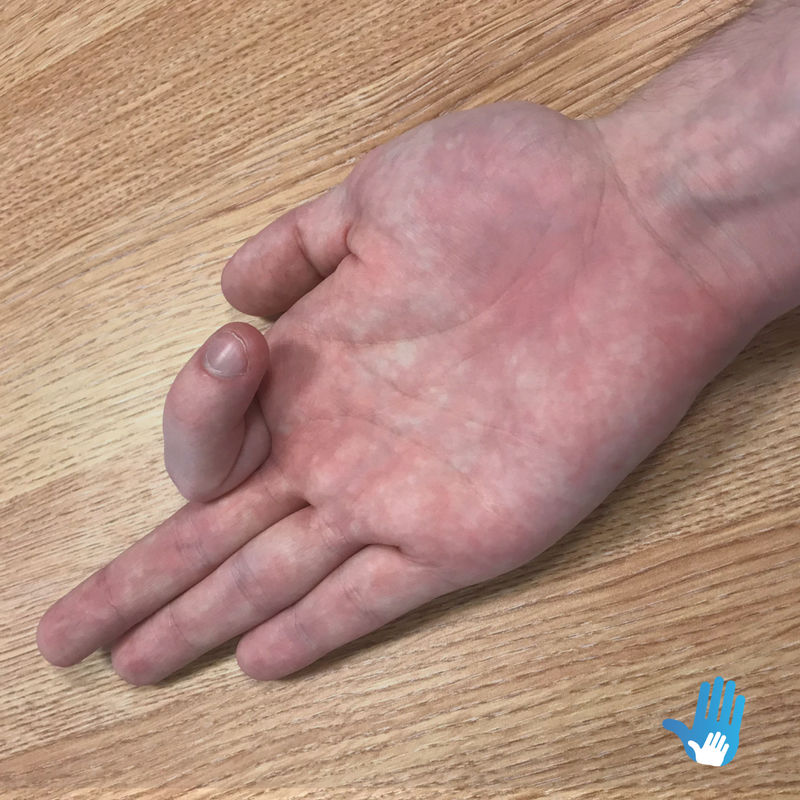 finger bend exercises for osteoarthritis