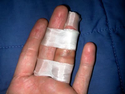 broken middle finger splint