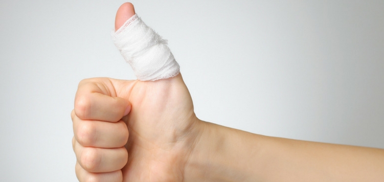 Broken Finger: Everything you need to know and what you should do