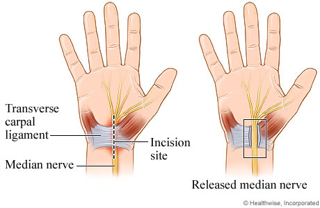 diagram of wrist