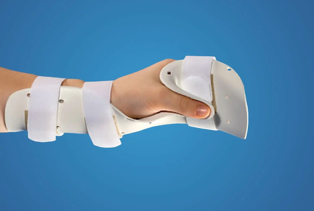 splint for hand fracture treatment
