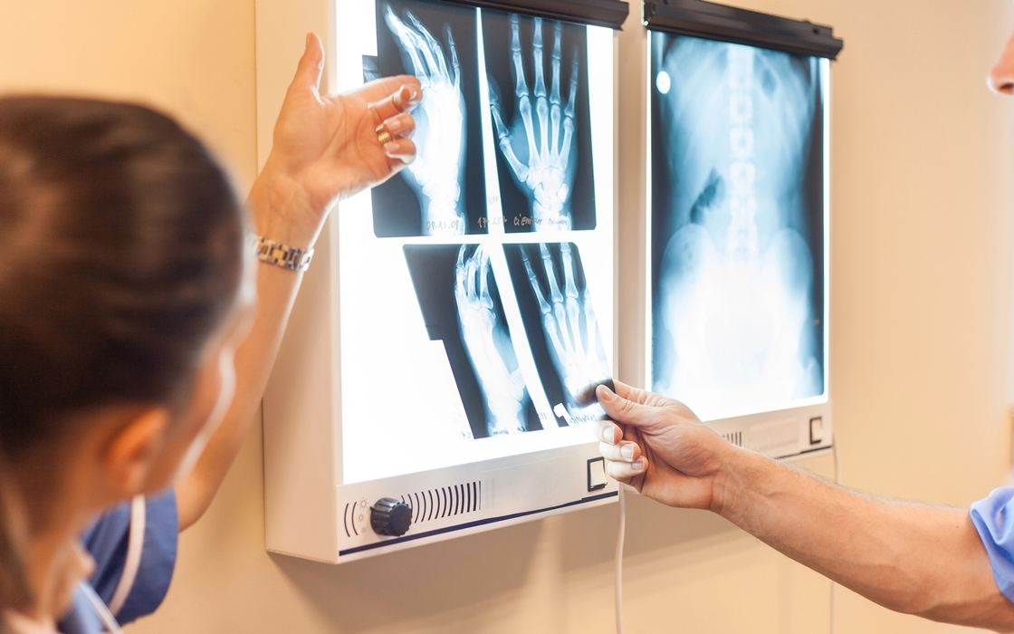 Diagnosing a Hand Fracture Explained