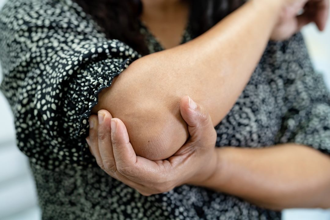 woman suffering with cubital tunnel syndrome, Ladan Hajipour