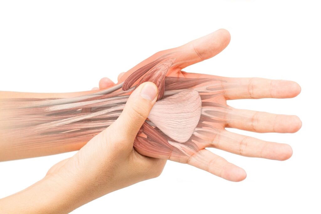 Hand Ligament Injuries Explained